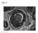 Fig. 08 - Scaffold for tissue regeneration in mammals