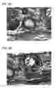 Fig. 09 - Scaffold for tissue regeneration in mammals