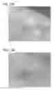Fig. 19 - Scaffold for tissue regeneration in mammals