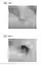 Fig. 23 - Scaffold for tissue regeneration in mammals