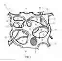 Fig. 02 - Reticulated elastomeric matrices, their manufacture and use in implantable devices