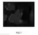 Fig. 07 - Drug Delivery Nanodevice, its Preparation Method and Uses Thereof
