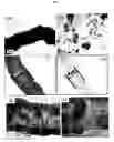 Fig. 06 - NANOSTRUCTURED MATERIAL LOADED WITH NOBLE METAL PARTICLES