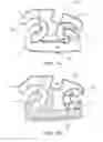 Fig. 02 - Orthodontic bracket and method