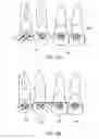 Fig. 08 - Orthodontic bracket and method
