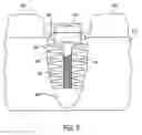 Fig. 03 - SYSTEM AND METHODS OF PRESERVING AN ORAL SOCKET