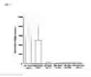 Fig. 02 - Method of detecting leukemic cell