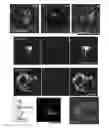 Fig. 01 - Neuronal cells cultured on microparticles and methods of using the neuronal cells