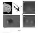Fig. 08 - Neuronal cells cultured on microparticles and methods of using the neuronal cells