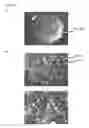 Fig. 07 - Method and apparatus for imaging target components in a biological sample using permanent magnets