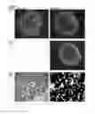 Fig. 09 - Method and apparatus for imaging target components in a biological sample using permanent magnets
