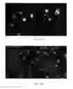 Fig. 04 - COMPOSITIONS AND PROCESSES RELATING TO HUMAN BOCAVIRUS