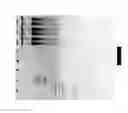 Fig. 28 - Methods for Identifying Genetic Linkage