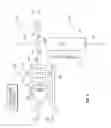 Fig. 04 - Methods and apparatus for the detection and differentiation of non-sialated proteins from sialated proteins in a fluid sample