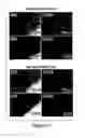 Fig. 03 - Humanized model of membrane attack complex (MAC) formation on murine retina and compositions, kits and methods for treatment of macular degeneration
