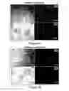 Fig. 07 - Humanized model of membrane attack complex (MAC) formation on murine retina and compositions, kits and methods for treatment of macular degeneration