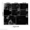 Fig. 09 - Humanized model of membrane attack complex (MAC) formation on murine retina and compositions, kits and methods for treatment of macular degeneration