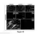Fig. 10 - Humanized model of membrane attack complex (MAC) formation on murine retina and compositions, kits and methods for treatment of macular degeneration