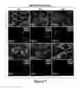 Fig. 12 - Humanized model of membrane attack complex (MAC) formation on murine retina and compositions, kits and methods for treatment of macular degeneration