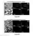 Fig. 14 - Humanized model of membrane attack complex (MAC) formation on murine retina and compositions, kits and methods for treatment of macular degeneration