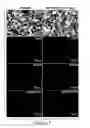Fig. 15 - Humanized model of membrane attack complex (MAC) formation on murine retina and compositions, kits and methods for treatment of macular degeneration