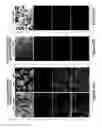 Fig. 16 - Humanized model of membrane attack complex (MAC) formation on murine retina and compositions, kits and methods for treatment of macular degeneration