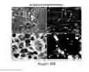 Fig. 19 - Humanized model of membrane attack complex (MAC) formation on murine retina and compositions, kits and methods for treatment of macular degeneration