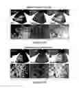 Fig. 27 - Humanized model of membrane attack complex (MAC) formation on murine retina and compositions, kits and methods for treatment of macular degeneration