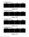 Fig. 31 - Humanized model of membrane attack complex (MAC) formation on murine retina and compositions, kits and methods for treatment of macular degeneration