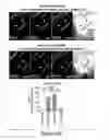 Fig. 33 - Humanized model of membrane attack complex (MAC) formation on murine retina and compositions, kits and methods for treatment of macular degeneration