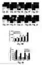 Fig. 07 - Hedgehog pathway antagonists methods of use