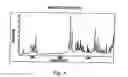 Fig. 04 - POLYMORPHIC FORMS OF 3-(4-AMINO-1-OXO-1,3 DIHYDRO-ISOINDOL-2-YL)-PIPERIDINE-2,6-DIONE