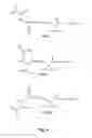 Fig. 07 - Combination of compounds, or a bifunctional compound, that provides fatty acid metabolism and glycolysis inhibition