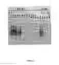 Fig. 06 - Synthesis of long-chain polyunsaturated fatty acids by recombinant cells