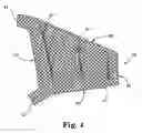 Fig. 04 - Surgical articles and methods for treating pelvic conditions