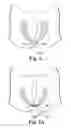 Fig. 09 - Surgical articles and methods for treating pelvic conditions