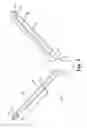 Fig. 03 - Articles, devices, and methods for pelvic surgery