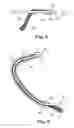 Fig. 04 - Articles, devices, and methods for pelvic surgery