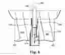 Fig. 06 - Articles, devices, and methods for pelvic surgery