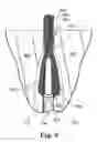 Fig. 07 - Articles, devices, and methods for pelvic surgery