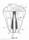 Fig. 08 - Articles, devices, and methods for pelvic surgery