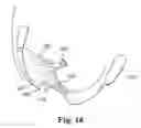 Fig. 12 - Articles, devices, and methods for pelvic surgery