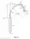 Fig. 13 - Articles, devices, and methods for pelvic surgery