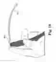 Fig. 15 - Articles, devices, and methods for pelvic surgery