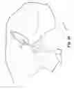 Fig. 16 - Articles, devices, and methods for pelvic surgery