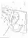 Fig. 10 - Guidewire locking device and method