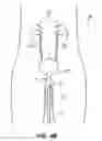 Fig. 16 - ENDOSCOPIC ROBOTIC CATHETER SYSTEM
