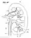 Fig. 28 - ENDOSCOPIC ROBOTIC CATHETER SYSTEM