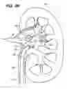 Fig. 30 - ENDOSCOPIC ROBOTIC CATHETER SYSTEM