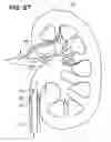 Fig. 32 - ENDOSCOPIC ROBOTIC CATHETER SYSTEM